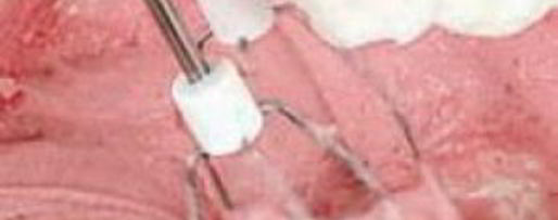 Шаг 2: мусса клюквенного из манной крупы