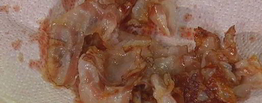 Шаг 2: салата с картофелем, беконом, фасолью и яйцами пашот