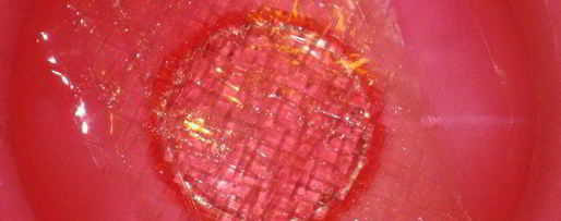 Шаг 1: сладкого десерта оливье с маскарпоне