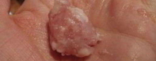 Шаг 2: супа с куриными фрикадельками и овощами