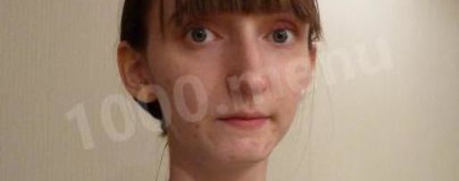 Шаг 7: шведских картофельных лепешек на сковороде