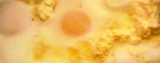 Шаг 3: глазуньи с творогом